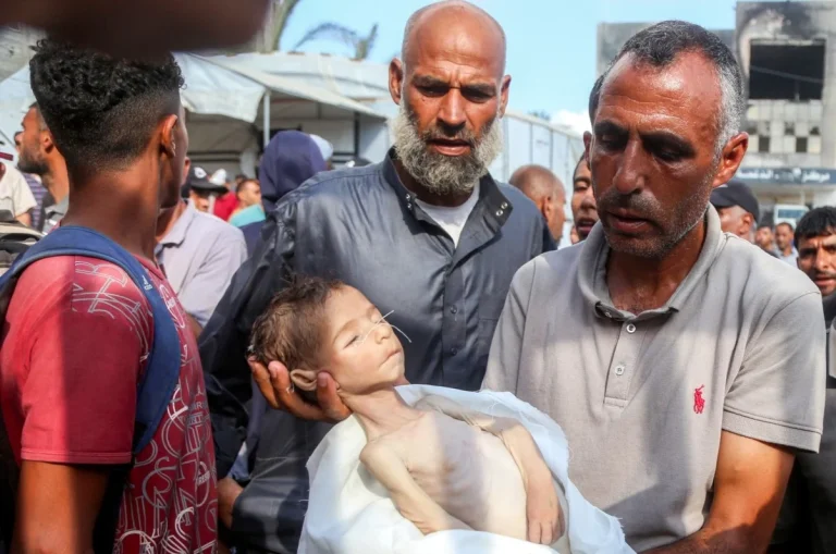 غزة: 76 طفلاً ارتقوا بسبب الجوع.. ونحو ألف شهيد من منتظري المساعدات خلال شهرين
